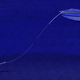 Image for article titled Two Kids, An IUD, and Then, An Abortion
